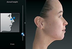 Vector 3d Face Imaging coco ruby Vector 3d Face Imaging coco ruby