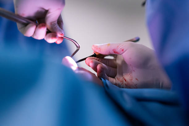 risks nose surgery - nose surgery Dr Stephen Kleid