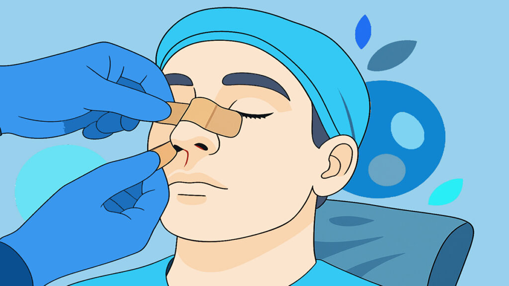 Melbourne ENT Male Rhinoplasty Bandage