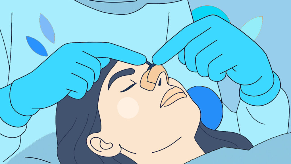 Melbourne-ENT-Operation-Rhinoplasty-Image Melbourne ENT Operation Rhinoplasty Image