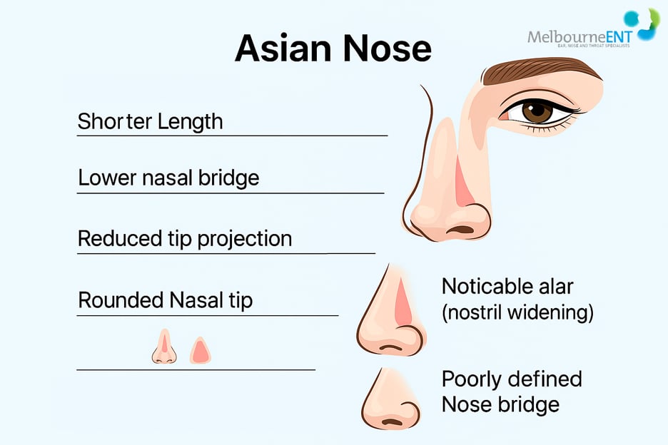 rhinoplasty-for-asian-noses-at-melbourne-ENT-clinic-What-are-Unique-Asian-Noses-Cosmetic-Features