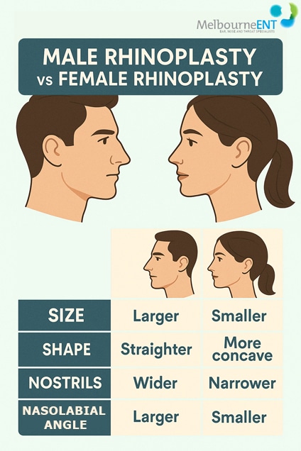 Rhinoplasty for Men at Melbourne ENT Clinic Male Rhinoplasty vs Female Rhinoplasty Rhinoplasty for Men at Melbourne ENT Clinic Male Rhinoplasty vs Female Rhinoplasty