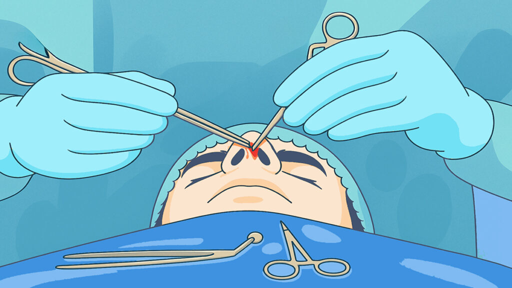 Melbourne-ENT-During-Nose-surgery Melbourne-ENT-During-Nose-surgery