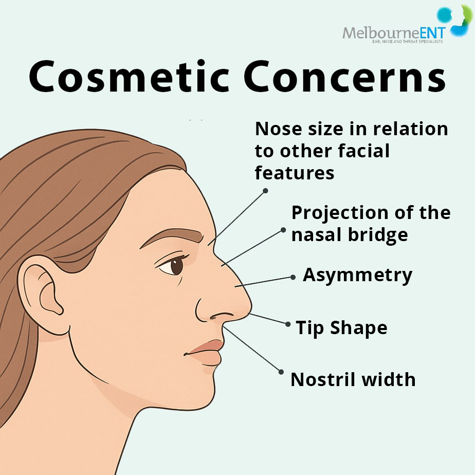 List of Nose Concerns that may require surgery