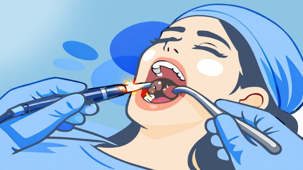 Do Tonsils Grow Back After Tonsillectomy - Melbourne ENT