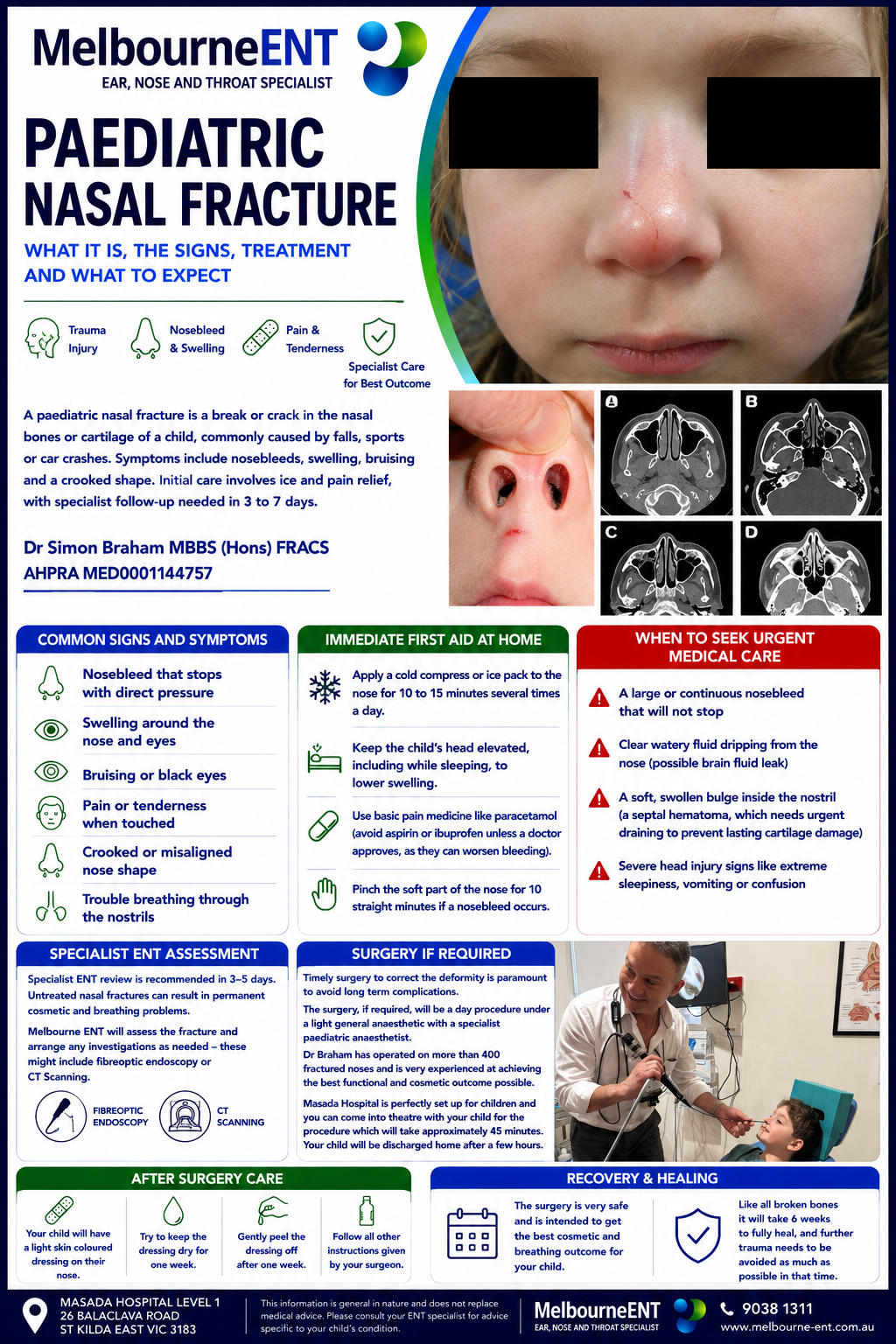 Paedatric nasal fracture Paedatric Nasal Fracture Brochure by Melbourne ENT