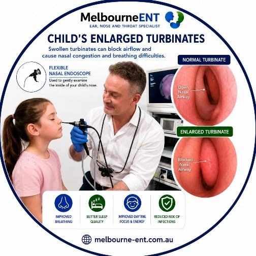 Child's Enlarged Turbinates Infographics by Dr Braham